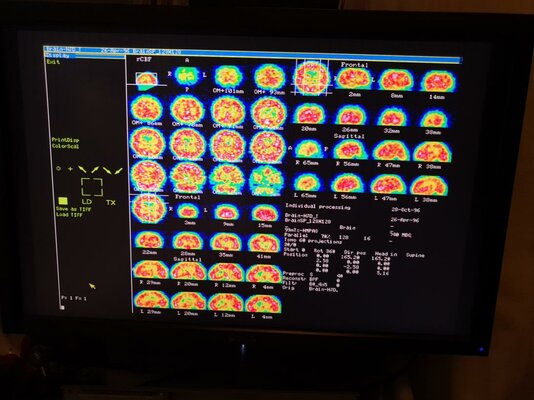 Click image for larger version  Name:	20211205_220602.jpg Views:	30 Size:	105.5 KB ID:	2405327