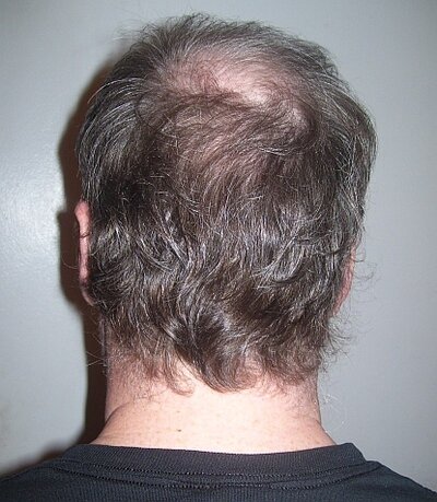 back of head.jpg
